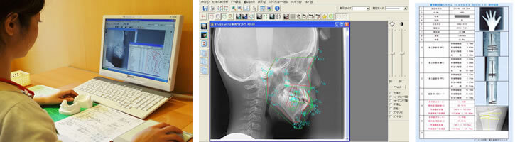 こだわり1　詳細かつ精密な矯正分析