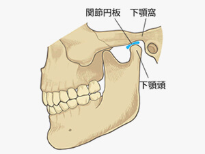 顎関節症の原因