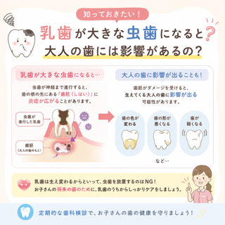 乳歯からのむし歯予防